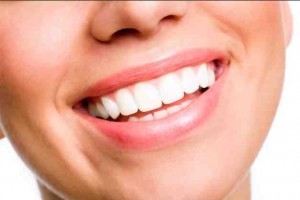 How To Heal Cavities Naturally For A Beautiful Smile